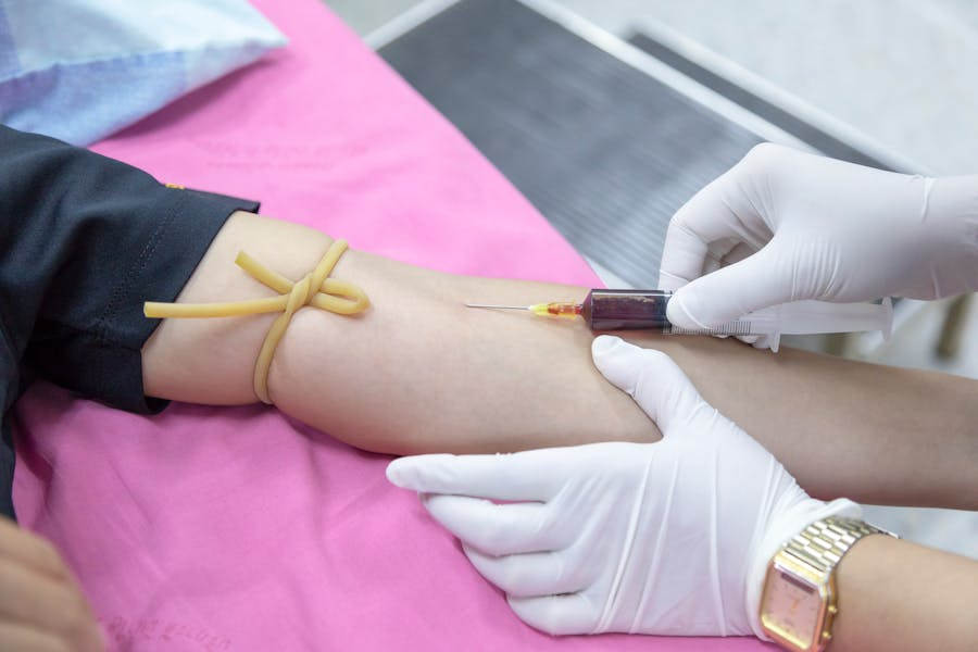 Breakthrough Blood Test Tracks Alzheimer’s Progression With 92% Accuracy