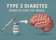 Type 3 Diabetes - How Diabetes Can Cause Alzheimer's Disease