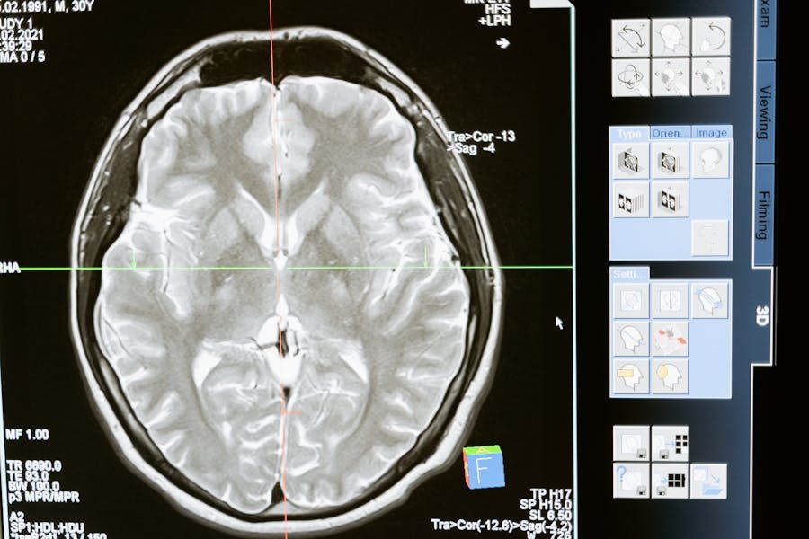 MRI Scans Show Cyclists Tend to Have Larger Hippocampus